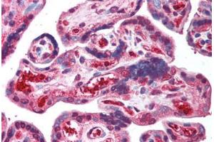 Human Placenta (formalin-fixed, paraffin-embedded) stained with ORAI2 antibody ABIN214005 at 5 ug/ml followed by biotinylated goat anti-rabbit IgG secondary antibody ABIN481713, alkaline phosphatase-streptavidin and chromogen.