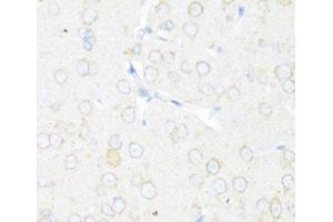 Immunohistochemistry of paraffin-embedded Rat brain using EIF3J Polyclonal Antibody at dilution of 1:100 (40x lens). (EIF3S1 Antikörper)