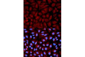 Immunofluorescence analysis of U2OS cells using SERPINC1 antibody.