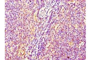 Immunohistochemistry of paraffin-embedded human lymph node tissue using ABIN7175013 at dilution of 1:100