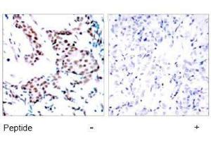 Image no. 1 for anti-Jun Proto-Oncogene (JUN) (Tyr170) antibody (ABIN197132) (C-JUN Antikörper  (Tyr170))