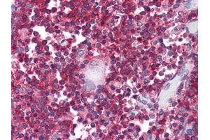 Immunohistochemical analysis of paraffin-embedded human Thymus tissues using anti-CD247 mouse mAb (CD247 Antikörper)