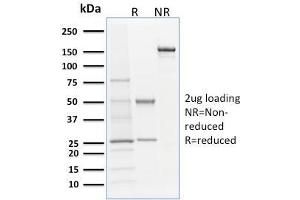 SDS-PAGE Analysis Purified Langerin Mouse Monoclonal Antibody (LGRN/1821).