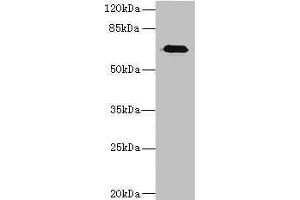 Western blot All lanes: CAPN6 antibody at 5 μg/mL + Human placenta tissue Secondary Goat polyclonal to rabbit IgG at 1/10000 dilution Predicted band size: 75 kDa Observed band size: 75 kDa (Calpain 6 Antikörper  (AA 195-494))