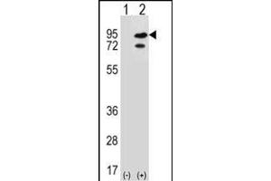 Western blot analysis of SNRK (arrow) using rabbit polyclonal SNRK Antibody (Center) (ABIN652303 and ABIN2841382). (SNRK Antikörper  (AA 320-349))