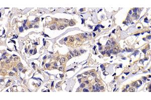 Immunohistochemistry (IHC) image for anti-BCL2-Like 1 (BCL2L1) (AA 2-212) antibody (ABIN7437176)