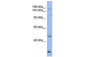 WB Suggested Anti-ATP7A Antibody Titration:  0.