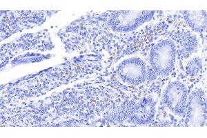 Detection of S100A12 in Bovine Small intestine Tissue using Polyclonal Antibody to S100 Calcium Binding Protein A12 (S100A12) (S100A12 Antikörper  (AA 2-92))