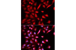 Immunofluorescence (IF) image for anti-Proteasome (Prosome, Macropain) 26S Subunit, ATPase, 3 (PSMC3) antibody (ABIN1874383) (PSMC3 Antikörper)