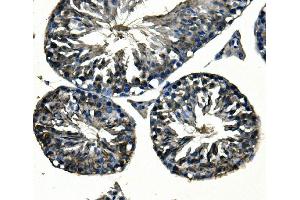 IHC analysis of Adam28 using anti-Adam28 antibody (ABIN7600945). (ADAM28 Antikörper  (AA 26-195))