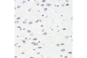 Immunohistochemistry of paraffin-embedded rat brain using CHD1 antibody (ABIN5975217) at dilution of 1/100 (40x lens). (CHD1 Antikörper)