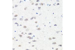 Immunohistochemistry of paraffin-embedded rat brain using CHD1 antibody (ABIN5975217) at dilution of 1/100 (40x lens).