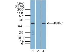 Image no. 1 for anti-Interferon Activated Gene 202B (Ifi202b) (AA 250-300) antibody (ABIN960219)