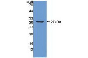 Detection of Recombinant PRSS2, Human using Polyclonal Antibody to Protease, Serine 2 (PRSS2)