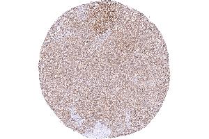 Moderate predominantly cytoplasmic MTAP staining of ovarian stroma cells (Rekombinanter MTAP Antikörper  (AA 95-197))