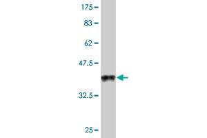 Western Blot detection against Immunogen (38. (Ghrelin Antikörper  (AA 1-117))