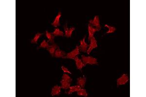 ABIN6272262 staining Hela by IF/ICC. (CABLES2 Antikörper  (Internal Region))