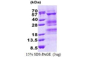 SDS-PAGE (SDS) image for Transcriptional Adaptor 3 (TADA3) (AA 1-432) protein (His tag) (ABIN5853220)