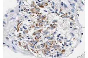 Immunohistochemistry (IHC) image for anti-BCL2-Like 1 (BCL2L1) (pSer62) antibody (ABIN6255430)