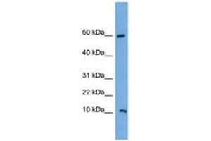 Image no. 1 for anti-Chromosome 20 Open Reading Frame 144 (C20orf144) (C-Term) antibody (ABIN6743651)
