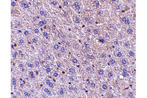 Immunohistochemistry (IHC) image for anti-Fem-1 Homolog B (FEM1B) (C-Term) antibody (ABIN1030384) (FEM1B Antikörper  (C-Term))