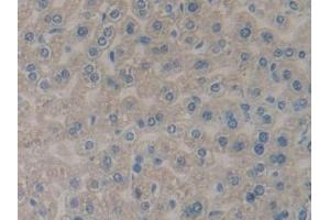 Immunohistochemistry (IHC) image for anti-phospholipase A2 Receptor 1, 180kDa (PLA2R1) (AA 1418-1487) antibody (ABIN7443389)