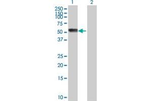 Western Blot analysis of AGT expression in transfected 293T cell line by AGT MaxPab polyclonal antibody.