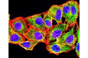 Immunofluorescence (IF) image for anti-Tumor Necrosis Factor Receptor Superfamily, Member 13B (TNFRSF13B) antibody (ABIN7193609)