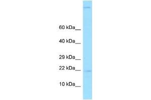 WB Suggested Anti-GKN2 Antibody Titration: 1. (Gastrokine 2 Antikörper  (N-Term))