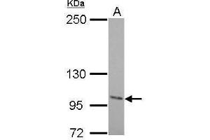 WB Image Autotaxin antibody detects ENPP2 protein by Western blot analysis. (ENPP2 Antikörper  (C-Term))