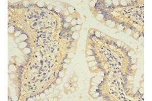 Immunohistochemistry of paraffin-embedded human small intestine tissue using ABIN7170961 at dilution of 1:100 (SULT1B1 Antikörper  (AA 1-271))