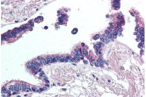Immunohistochemistry (IHC) image for anti-Wingless-Type MMTV Integration Site Family Member 2 (WNT2) (Internal Region) antibody (ABIN1049474)