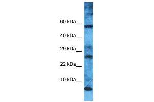 Western Blotting (WB) image for anti-Mitochondrial Ribosomal Protein L52 (MRPL52) (N-Term) antibody (ABIN2791671)