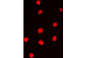 Immunofluorescent analysis of Cyclin E1 staining in PC12 cells. (Cyclin E1 Antikörper  (Center))