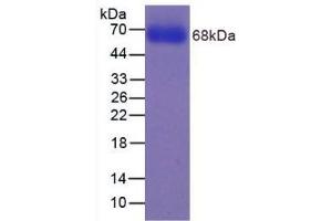 SDS-PAGE analysis of Human CYP2E1 Protein. (CYP2E1 Protein)