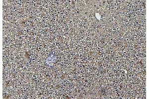 IHC analysis of ALDOB using anti-ALDOB antibody (ABIN7602563).