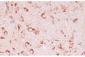 Immunohistochemistry of paraffin-embedded Rat brain using ENTPD6 Polyclonal Antibody at dilution of 1:100 (40x lens). (ENTPD6 Antikörper)