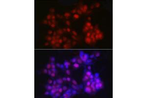 Immunofluorescence analysis of LNCaP cells using NKX3. (NKX3-1 Antikörper)