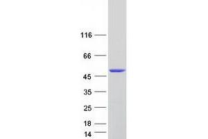 Western Blotting (WB) image for Snurportin 1 (SNUPN) (Transcript Variant 2) protein (Myc-DYKDDDDK Tag) (ABIN2732327)