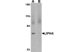 Western Blotting (WB) image for anti-Junctophilin 4 (JPH4) (C-Term) antibody (ABIN1030461) (Junctophilin 4 Antikörper  (C-Term))