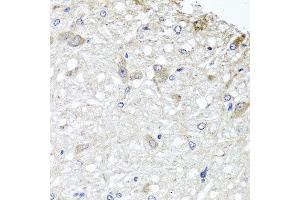 Immunohistochemistry of paraffin-embedded rat brain using METTL13 antibody at dilution of 1:100 (x40 lens). (METTL13 Antikörper)