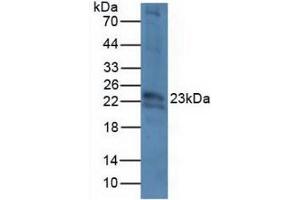 Figure. (CRYbB2 Antikörper  (AA 17-191))