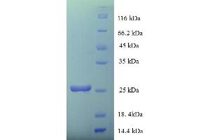 SDS-PAGE (SDS) image for Prion Protein (PRNP) (AA 29-231) protein (His tag) (ABIN5710151) (PRNP Protein (AA 29-231) (His tag))