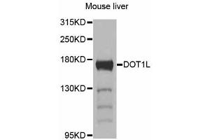 Western blot analysis of extracts of mouse liver, using DOT1L antibody (ABIN6292027) at 1:1000 dilution.