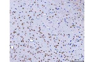 IHC analysis of HnRNP H/HNRNPH1 using anti-HnRNP H/HNRNPH1 antibody (ABIN4886623).