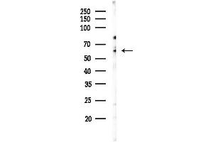 Western blot analysis of lysates from Hela cells(starvation,24h treatment), using SLC16 Antibody at 1/1000 dilution.
