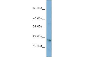 WB Suggested Anti-C17orf64 Antibody Titration: 0. (C17orf64 Antikörper  (Middle Region))