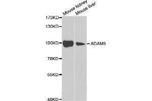 Western blot analysis of extracts of various cell lines, using ADAM9 antibody (ABIN5973121) at 1/1000 dilution. (ADAM9 Antikörper)