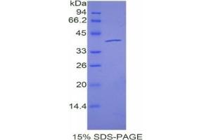 SDS-PAGE analysis of Mouse Angiopoietin 4 Protein.