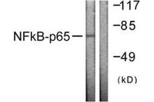 Western blot analysis of extracts from HeLa cells, using NF-kappaB p65 (Ab-505) Antibody. (NF-kB p65 Antikörper  (AA 471-520))